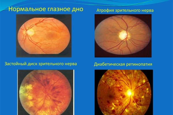 Кракен нов